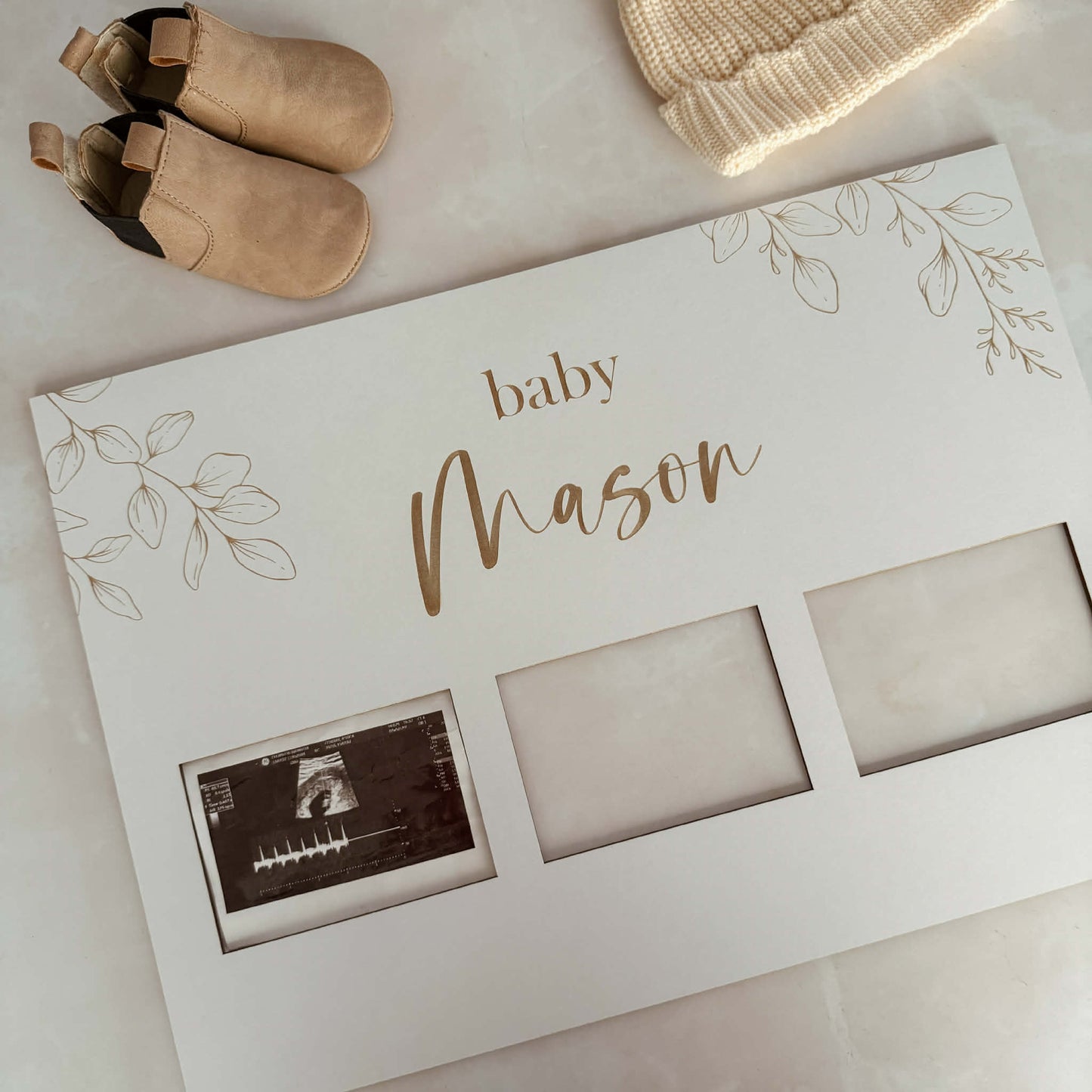 Pregnancy ultrasound photos | suits from 1 to 6 photos