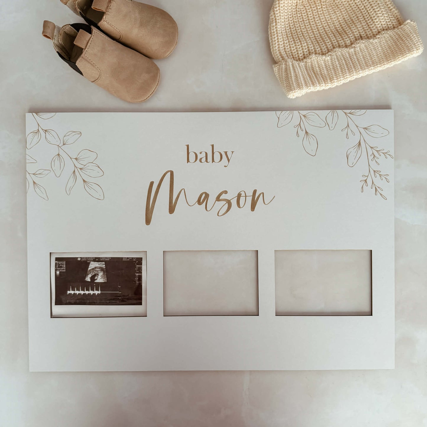 Pregnancy ultrasound photos | suits from 1 to 6 photos